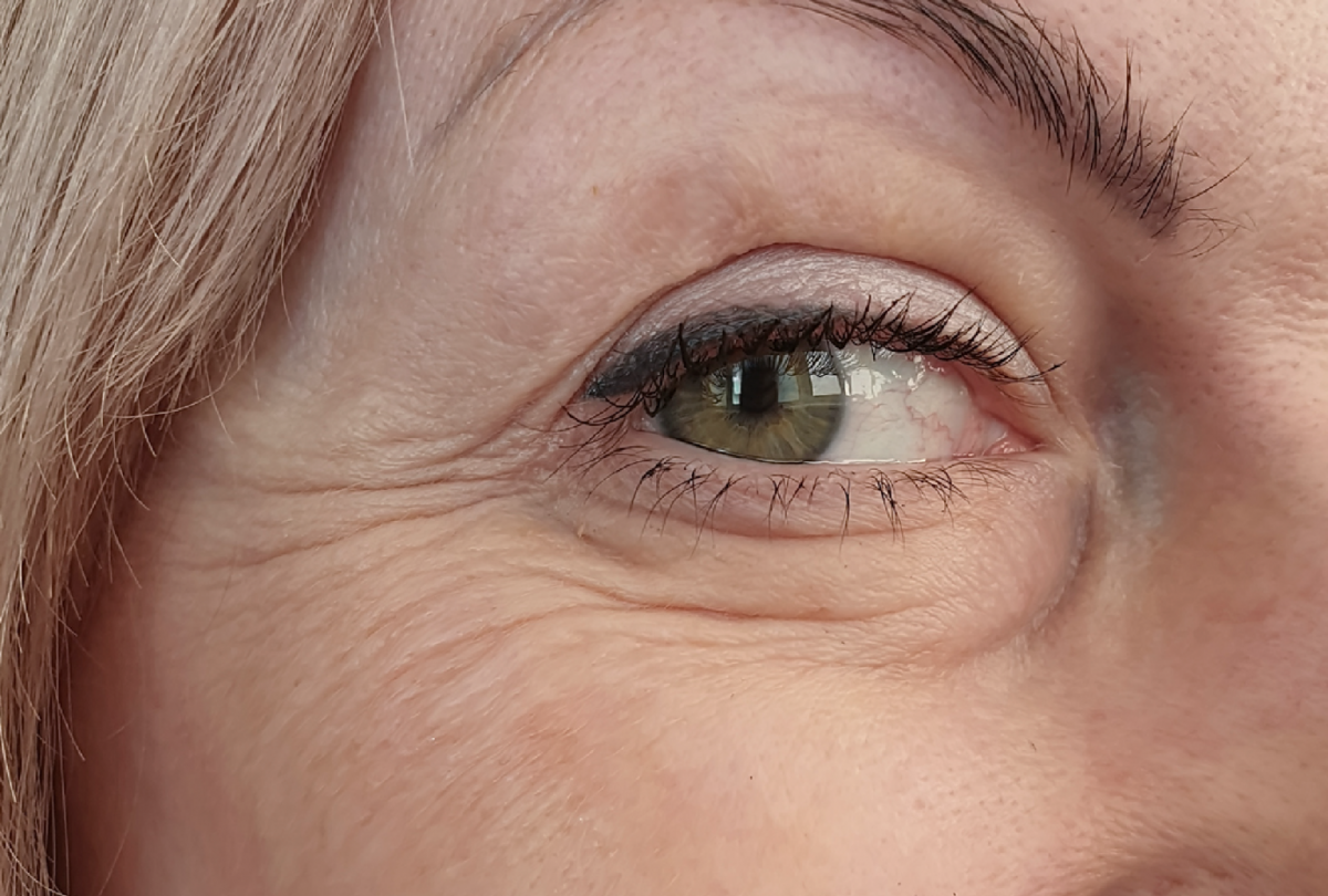 5 effective methods to prevent premature wrinkles