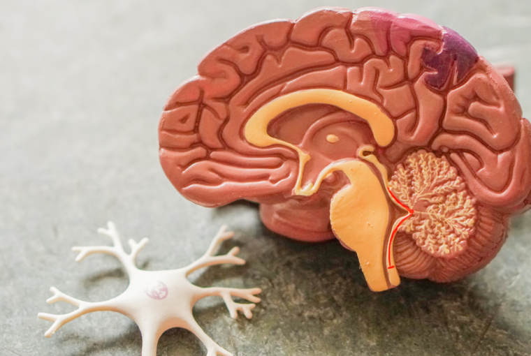 Clearing the haze: Tips for boosting cognitive performance and overcoming brain fog.
